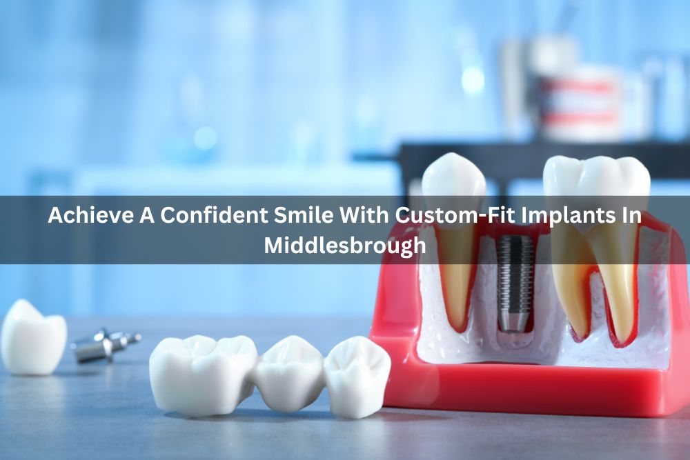 Achieve A Confident Smile With Custom-Fit Implants In Middlesbrough
