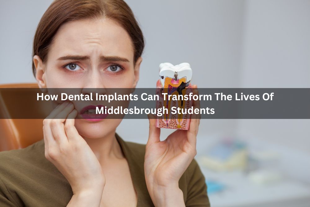 How Dental Implants Can Transform The Lives Of Middlesbrough Students