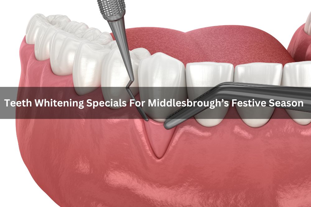 Teeth Whitening Specials For Middlesbrough’s Festive Season