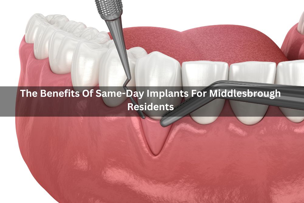The Benefits Of Same-Day Implants For Middlesbrough Residents